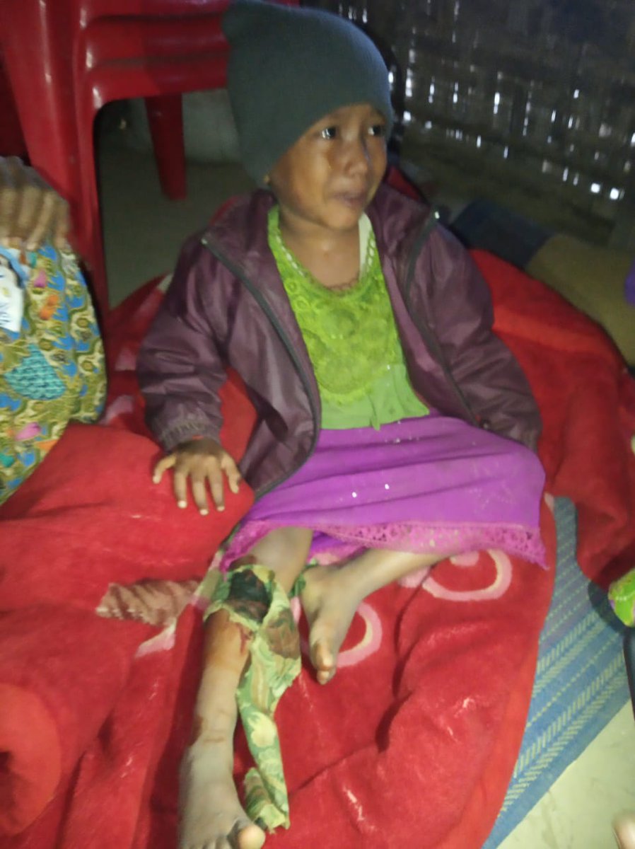 Buthidaung-based Myanmar military battalions have been firing indiscriminately mostly every night. On Monday morning at 4am a 7-year-old Rohingya girl from SinThayPyin hamlet was hit by bullet