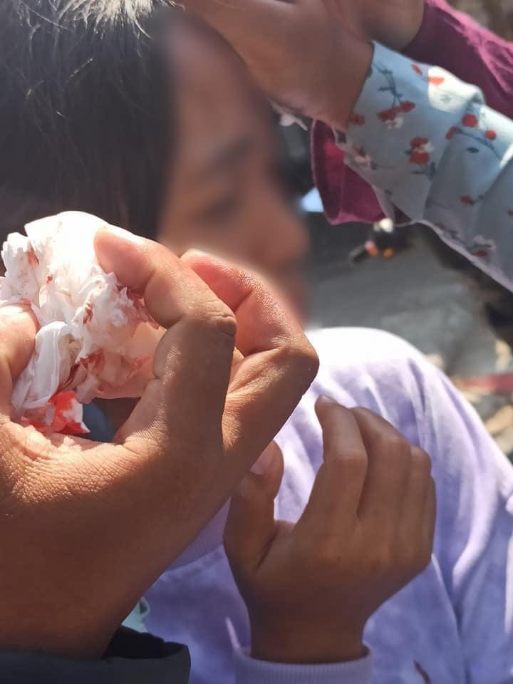 Myitkyina: Security forces attacked the protesters using slingshots. Protesters were peacefully conducting mobile protest riding motorcycles. But police attacked them from their trucks. 