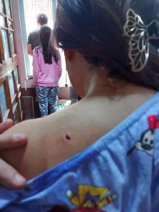 Heavy clashes ongoing between government forces and joint forces of Kachin Independent Army (EAO) and civilian People's defense forces in Kawlin, Sagaing region. Some civilians injured from Myanmar military's heavy artillery shells, locals say.  